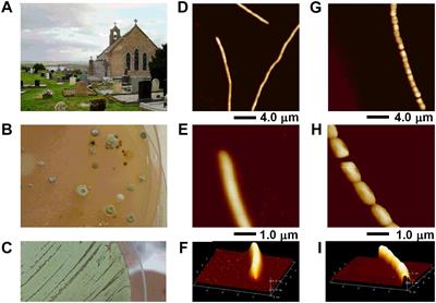 A Novel Alkaliphilic Streptomyces Inhibits ESKAPE Pathogens